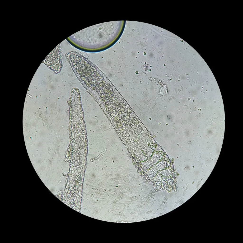 acari demodex rogna demodettica al microscopio